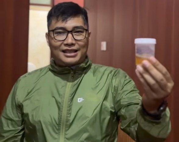 Sastra Winara Jalani Tes Urine, Tegaskan Komitmen DPRD Kabupaten Bogor Perangi Narkoba